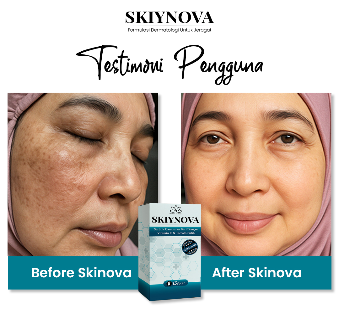 Testimoni pengguna Skiynova 2