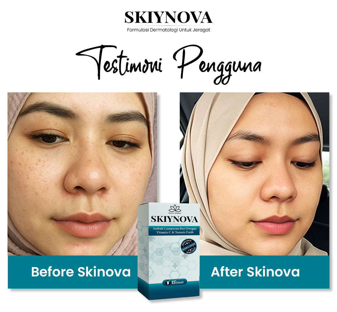Testimoni pengguna Skiynova 1